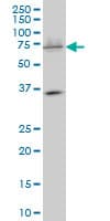 Monoclonal Mouse anti-Human BAF60C / SMARCD3 Antibody (clone 1G6, IF, WB)