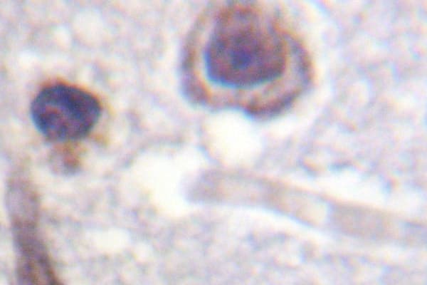 Polyclonal Rabbit anti-Human CASR/Calcium Sensing Receptor Antibody (Ala884, IHC, WB)