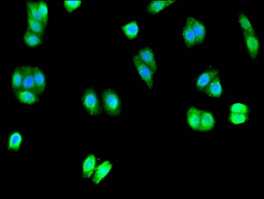 Polyclonal Rabbit anti-Human UNC80 Antibody (IF)