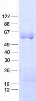 Human HPSE / Heparanase Protein (Recombinant His, N-Terminal)