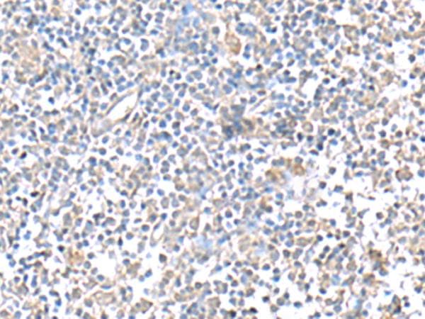 IFI27 / p27 Antibody