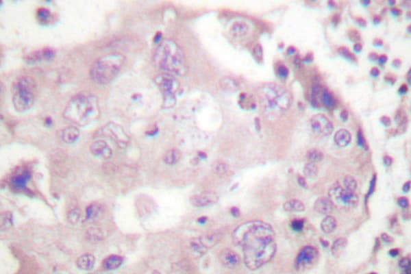 STAT4 Antibody (Glu687)
