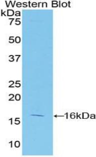 CASP2 / Caspase 2 Antibody (aa334-452)
