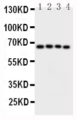 CAMKK2 Antibody (aa180-194)