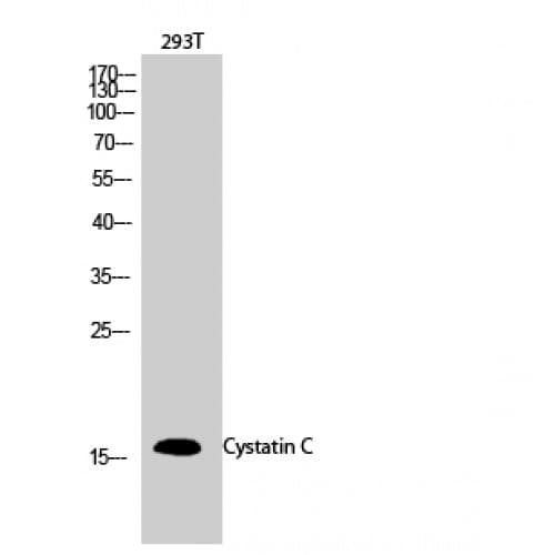 CST3 / Cystatin C Antibody (60-140 aa, Internal)