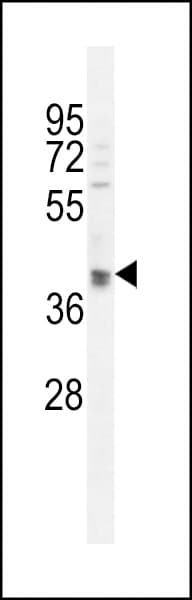 OTUD3 Antibody (aa192-220)