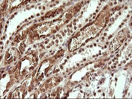 UPRT Antibody (clone OTI2F2)
