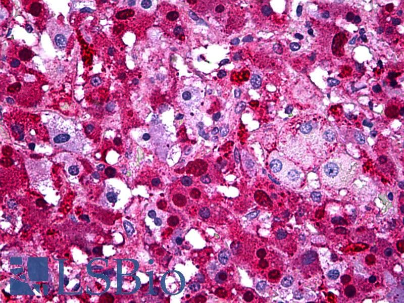 PathPlus™ Monoclonal Mouse anti-Human Alpha-1-Antichymotrypsin Antibody (clone 1E6, IHC, WB)