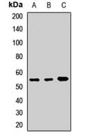 PathPlus™ Polyclonal Rabbit anti-Human LSP1 Antibody (IHC, WB)