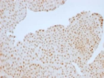 RB1 / Retinoblastoma / RB Antibody (clone RB1/1754)