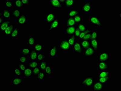 HIST1H3A Antibody (phospho-Ser28)