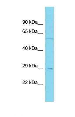 EEF2KMT / FAM86A Antibody (aa191-240)