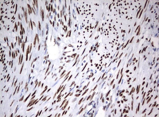Monoclonal Mouse anti-Human ZSCAN18 / ZNF447 Antibody (clone UMAB114, IHC, WB)