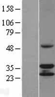 CCDC44 / TACO1 Protein (Over-Expression Lysate Myc-DDK (Flag))