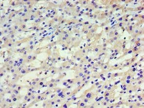 HARS Antibody (aa1-180)