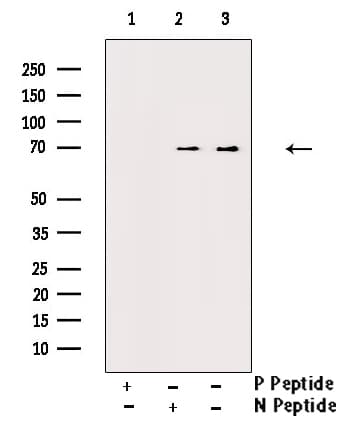 MAP3K7 / TAK1 Antibody (phospho-Thr187)