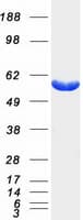 Human PFKFB4 Protein (Recombinant Myc-DDK (Flag))
