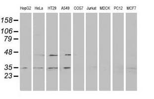 RDH14 Antibody (clone OTI4G8)