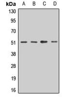 DDOST / OST48 Antibody