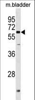 PGM2L1 Antibody (aa491-518)
