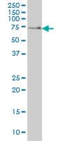 SH3BP2 Antibody (clone 1E9)