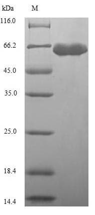 Arabidopsis thaliana ALS (A. thaliana) Protein (Recombinant 6His, N-terminus)