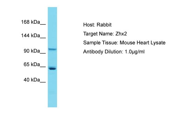 ZHX2 / RAF Antibody (aa703-752)