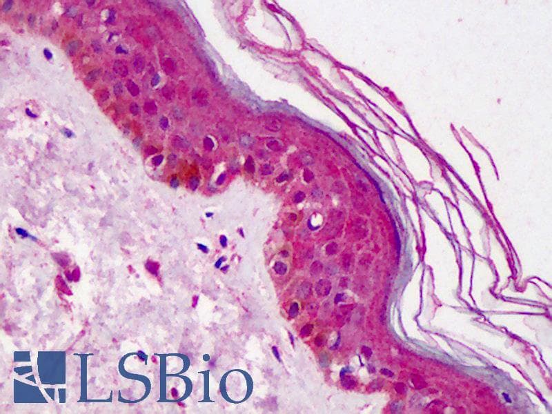 IHC-plus™ DOK1 Antibody