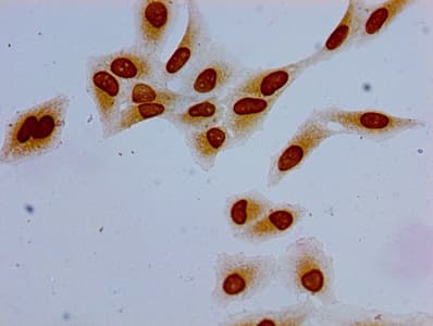 HIST1H1E Antibody