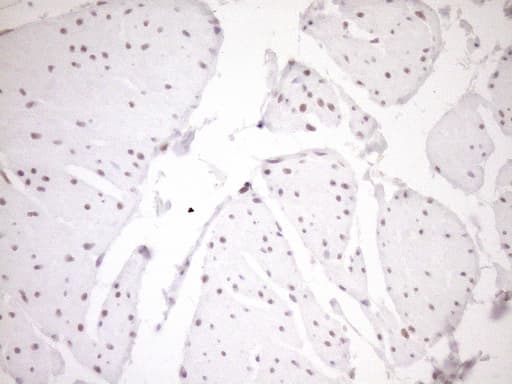 NR1H3 / LXR Alpha Antibody (aa69-329, clone OTI1A5)