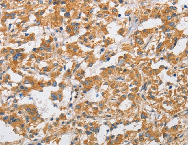 ARHGAP15 Antibody