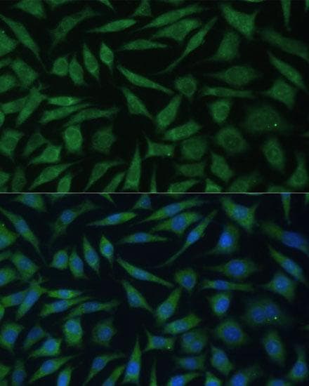 REXO2 Antibody