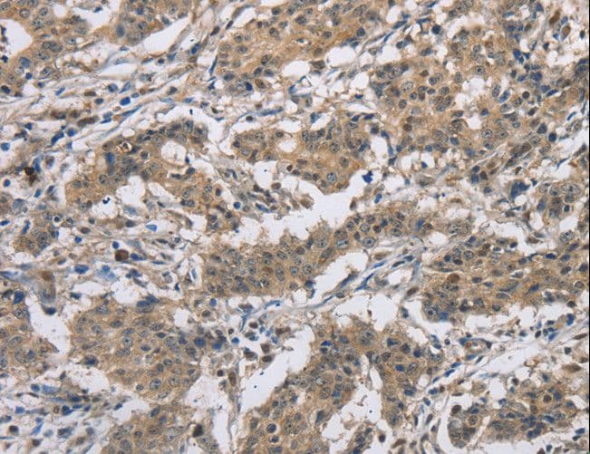 IHC-plus™ DSG2 / Desmoglein 2 Antibody