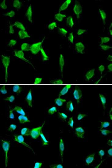 Polyclonal Rabbit anti-Human TOPBP1 Antibody (IHC, IF, WB)