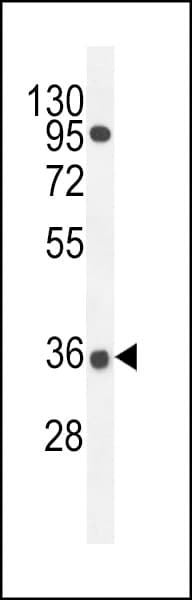 Polyclonal Rabbit anti-Human PRR19 Antibody (aa208-236, WB)