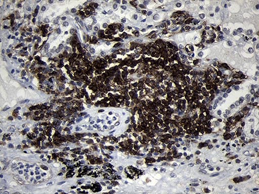 CD79B / CD79 Beta Antibody (clone OTI4E11)