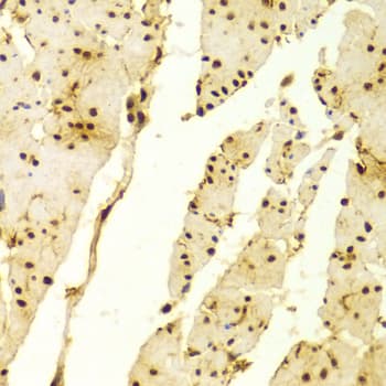 Polyclonal Rabbit anti-Human MSH2 Antibody (IHC, IF, WB)
