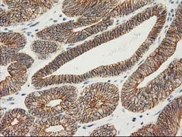 CTNNB1 / Beta Catenin Antibody (clone OTI1B11)