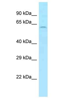 SLC11A1 / NRAMP Antibody (aa211-260)