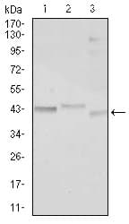 Monoclonal Mouse anti-Human C/EBP Alpha / CEBPA Antibody (clone 5B7, IHC, IF, WB)