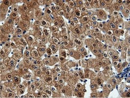 QPRT Antibody (clone OTI4E6)