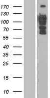 DLC1 Protein (Over-Expression Lysate Myc-DDK (Flag))