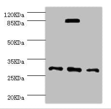 NNMT Antibody