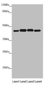 Polyclonal Rabbit anti-Human PDHA2 / PDH E1 Beta Antibody (IHC, WB)