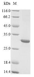 Chum salmon L-rhamnose-binding lectin CSL3 Protein (Recombinant 10His, N-terminus)