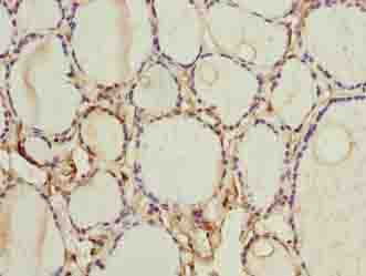 Polyclonal Rabbit anti-Human FOXR2 Antibody (IHC, WB)