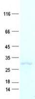 Human NABP1 / OBFC2A Protein (Recombinant His, N-Terminal)