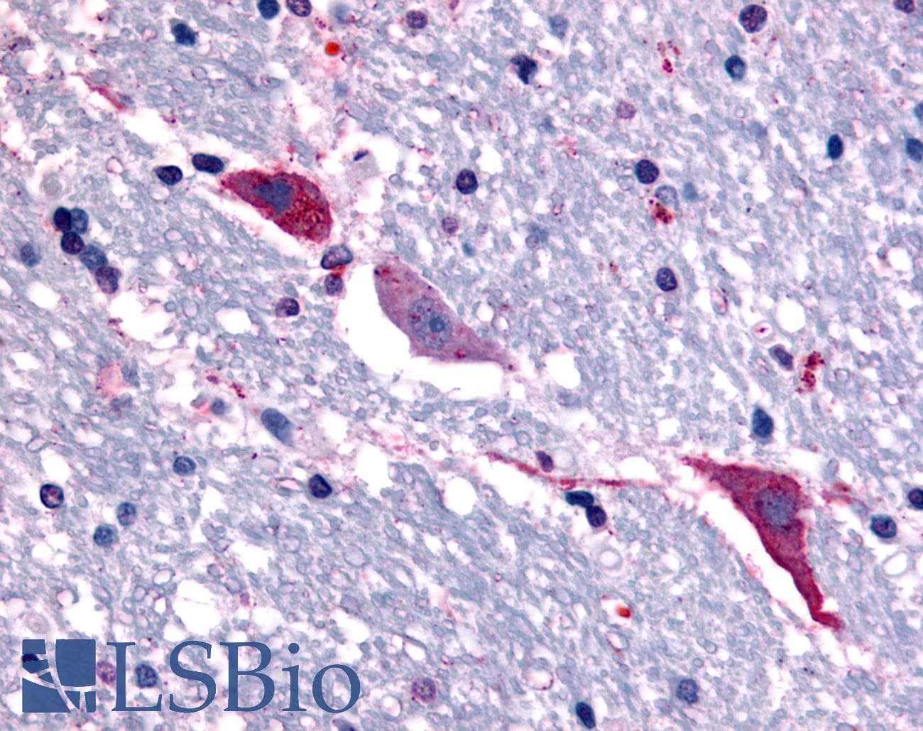 IHC-plus™ Polyclonal Rabbit anti-Human TACR3 / NK3R Antibody (C-Terminus, IHC)