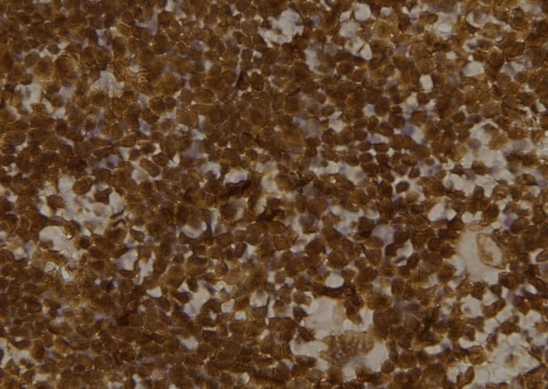 MLST8 / GBL Antibody