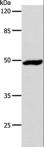 DRD1 / Dopamine Receptor D1 Antibody